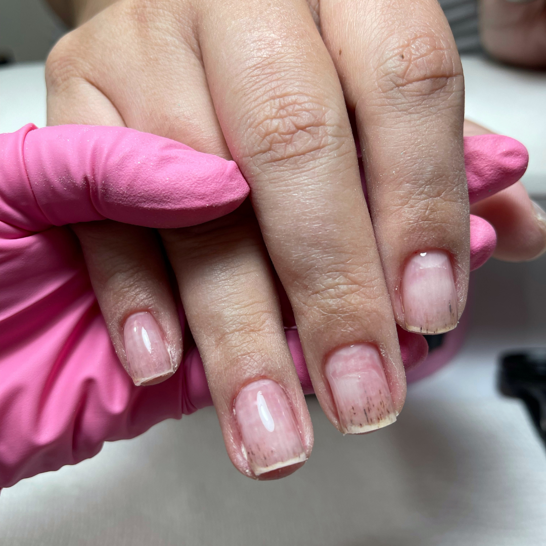 AntiFungus Nail Oil Treatment