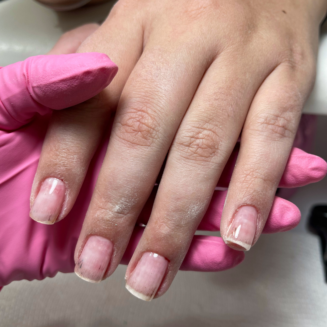 AntiFungus Nail Oil Treatment